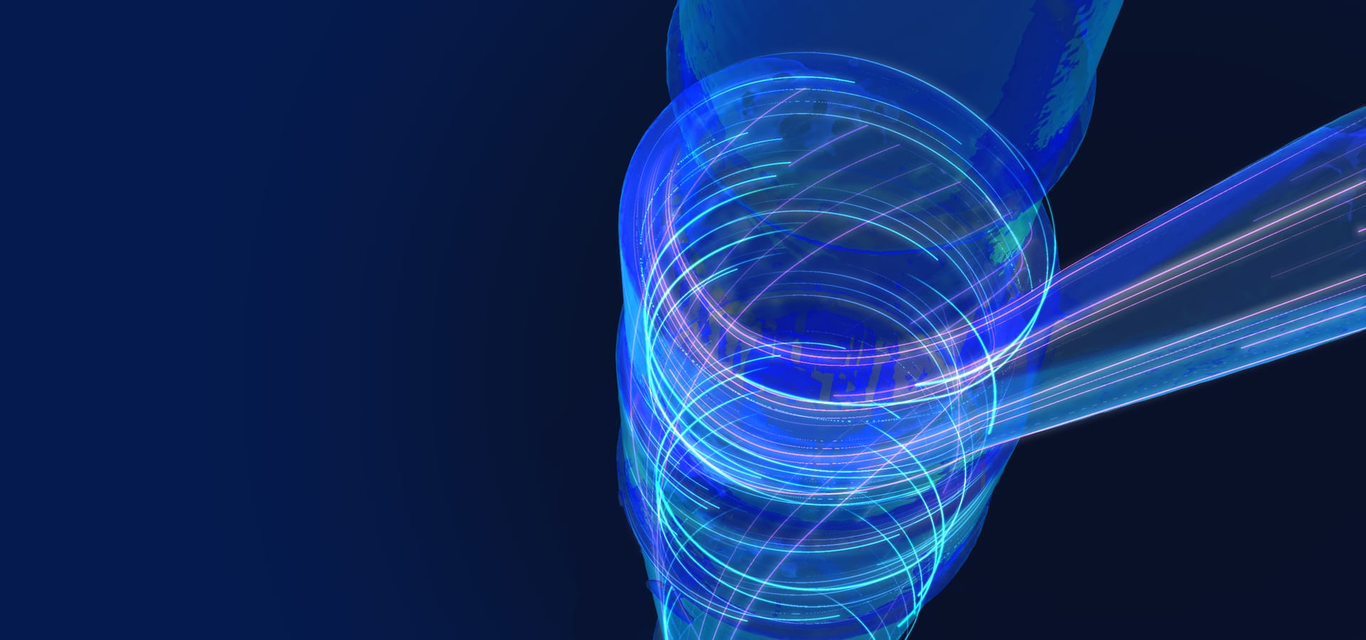 Sand Separator - PSS